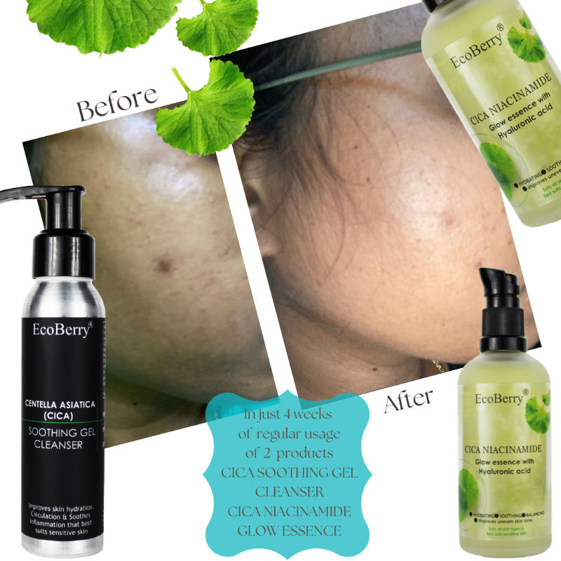 Ecoberry Cica Niacinamide Glow Essence with Hyaluronic Acid