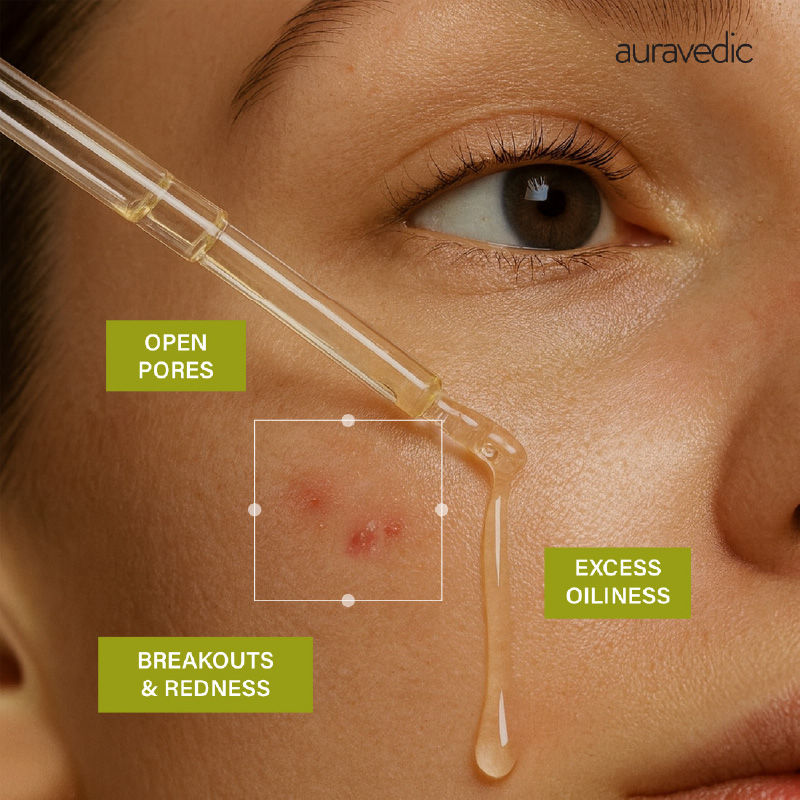 Auravedic Tea Tree Oil Salicylic acid Face Serum for Acne Prone Skin Pore Minimizing Serum