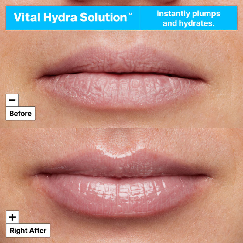 Dr.Jart+ Vital Hydra Solution Hydrating Lip Mask With Hyaluronic Acid – Leave-On Lip Balm