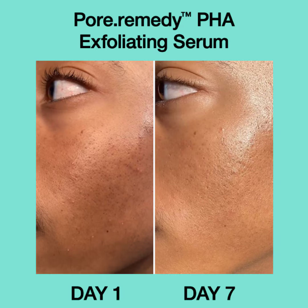 Dr.Jart+ Pore Remedy Pha Exfoliating Serum – Gentle Smoothing Serum For Blackheads & Oil Control