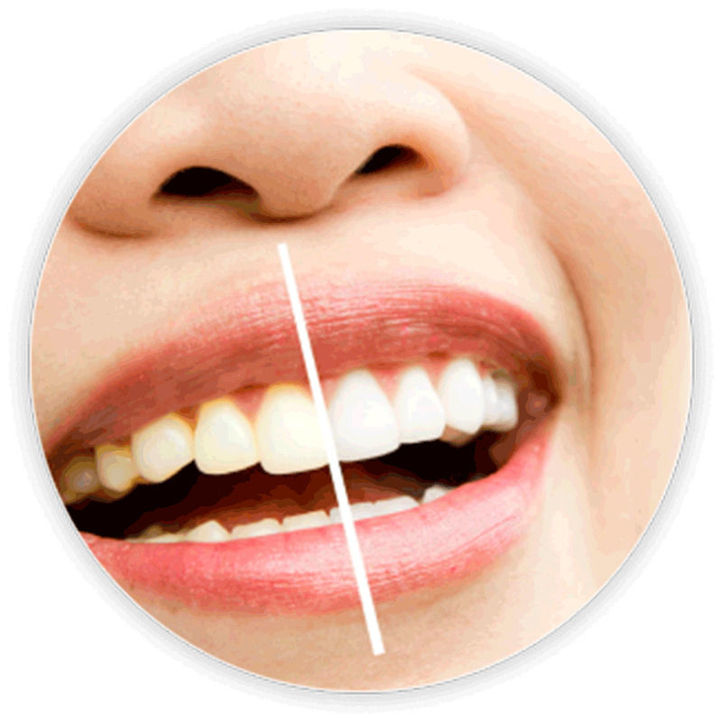 Bonayu Teeth Whitening Strips + Sensitivity Strips