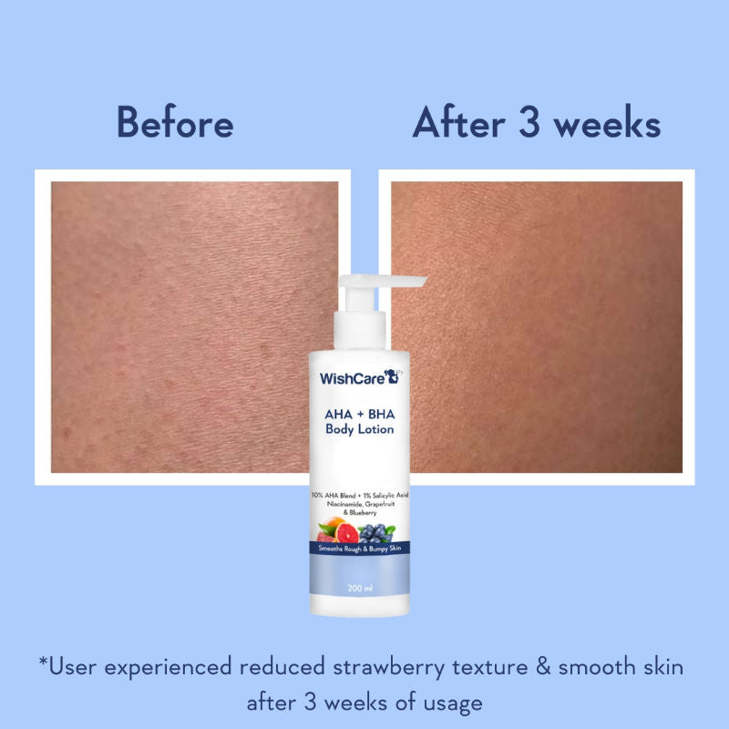 WishCare AHA + BHA Exfoliating Body Lotion for Strawberry Skin-Provides Deep Hydration & Detan Skin