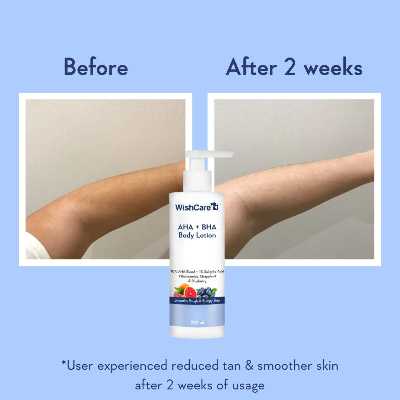 WishCare AHA + BHA Exfoliating Body Lotion for Strawberry Skin-Provides Deep Hydration & Detan Skin
