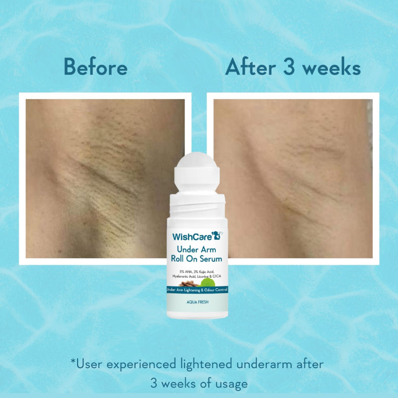 WishCare Aqua Fresh Underarm Roll On Serum-Reduces Pigmentation,Brightens Skin & Prevents Body Odour