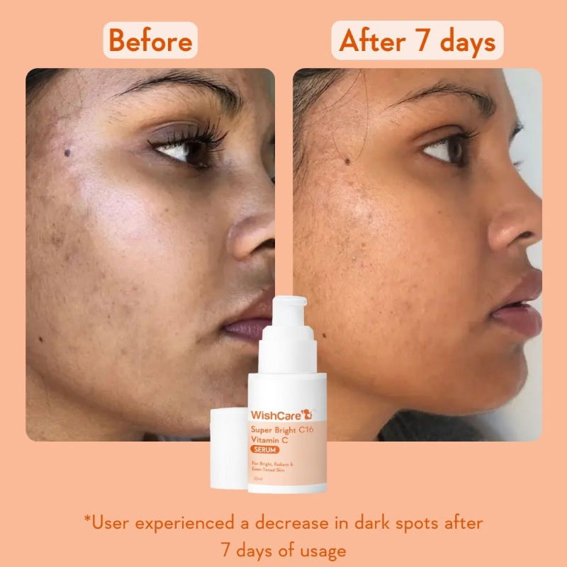 WishCare Super Bright C16 Vitamin C Face Serum for Glowing Skin- Reduces Pigmentation & Dark Spots