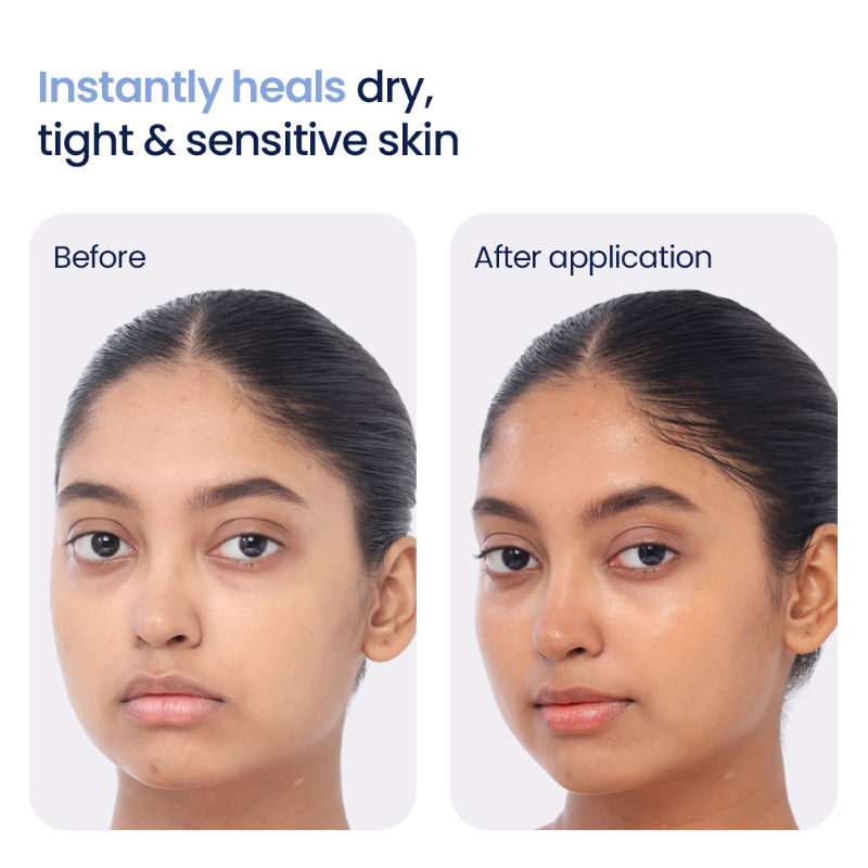 WishCare 3:1:1 Barrier Bounce Moisturizer for Dry Skin with Ceramides &Mung Mucin for Barrier Repair