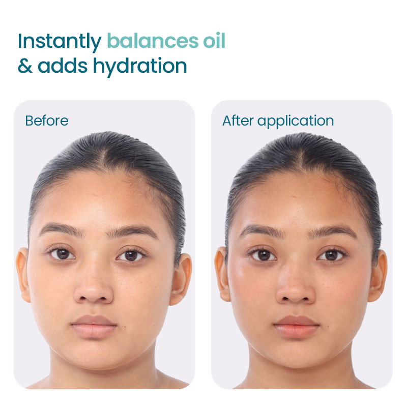 WishCare 2:1:3 NMF Oil Free Water Gel Moisturizer for Oily & Acne Prone Skin with Niacinamide & Cica