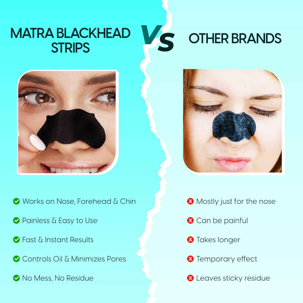 Matra Blackhead Remover Nose Strips - Charcoal Pore Cleansing for Nose, Forehead & Chin