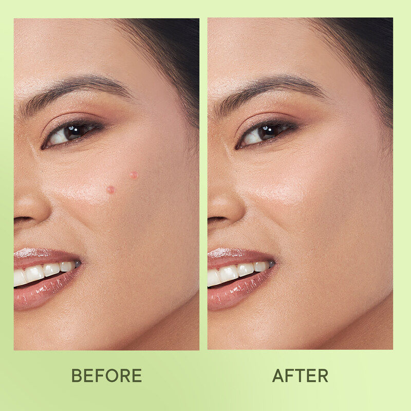 Quench Cica & Salicylic Acid Acne Pimple Patches