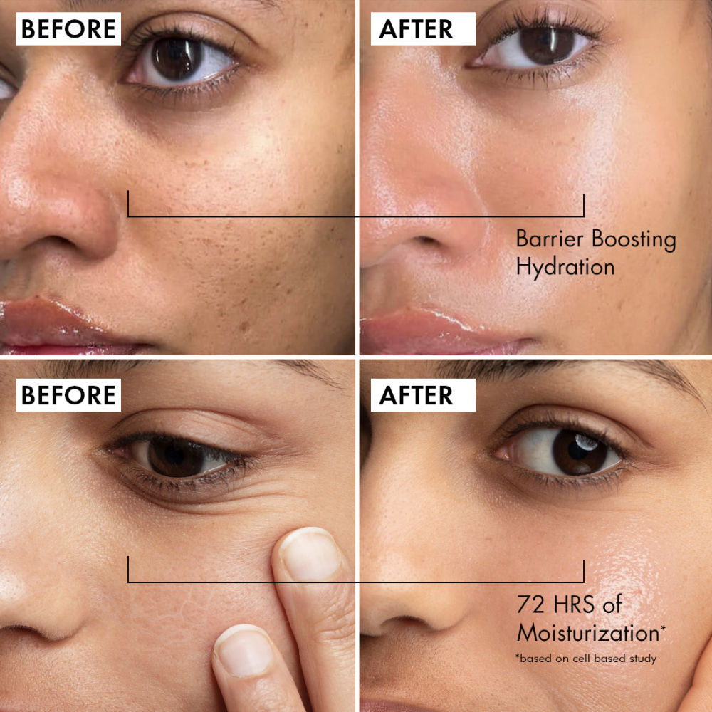MCaffeine Oil-Free Coffee Face Moisturizer Gel with Hyaluronic Acid & Pro-Vit B5 for Deep Hydration