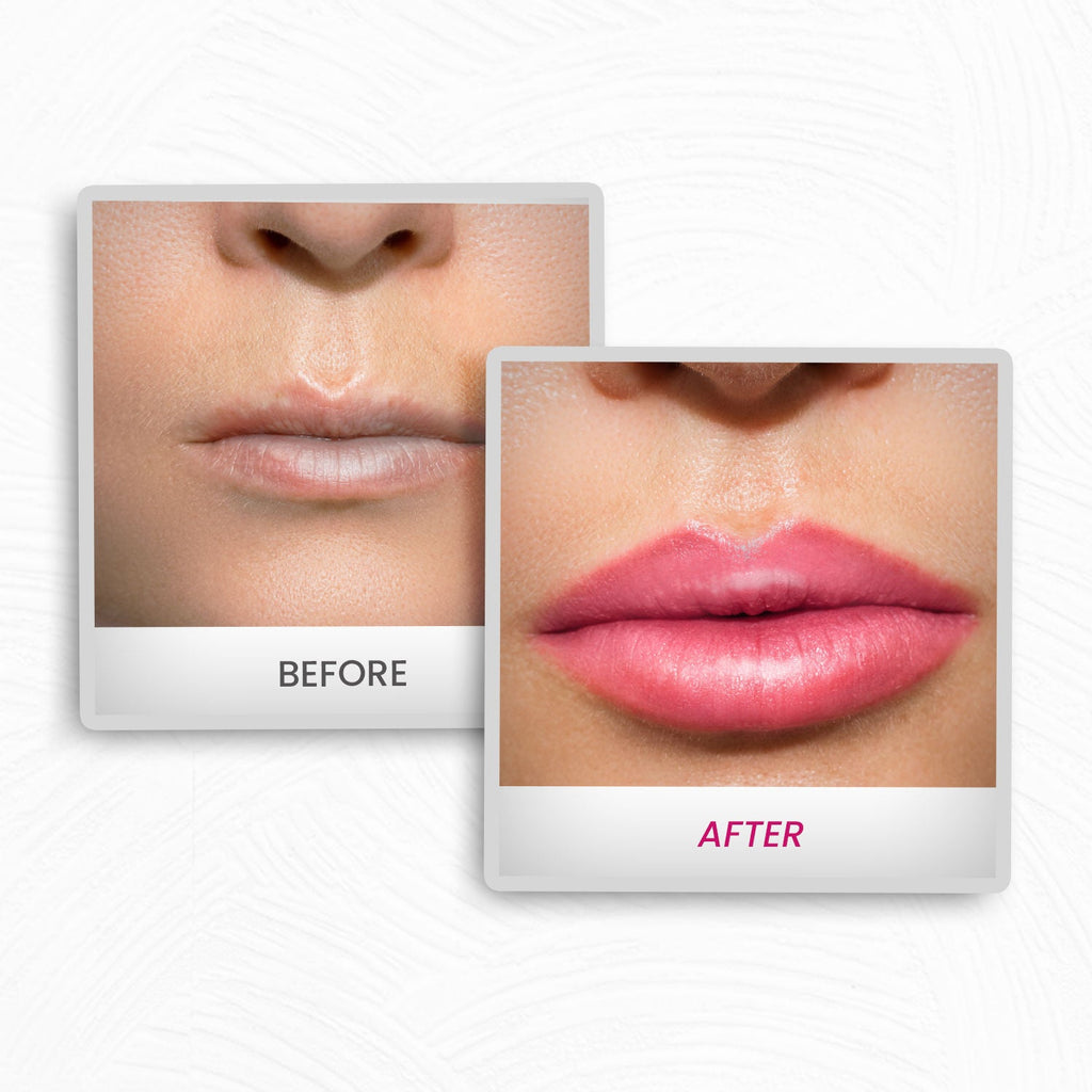 Protouch Lip Plumping Drops