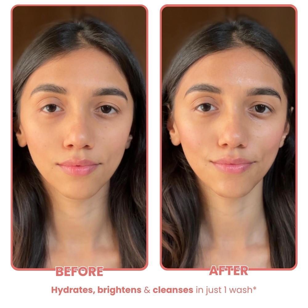 THE SKIN DIET COMPANY Watermelon Hyaluronic + Salicylic Acid Face Wash for Dull, Dry & Oily Skin