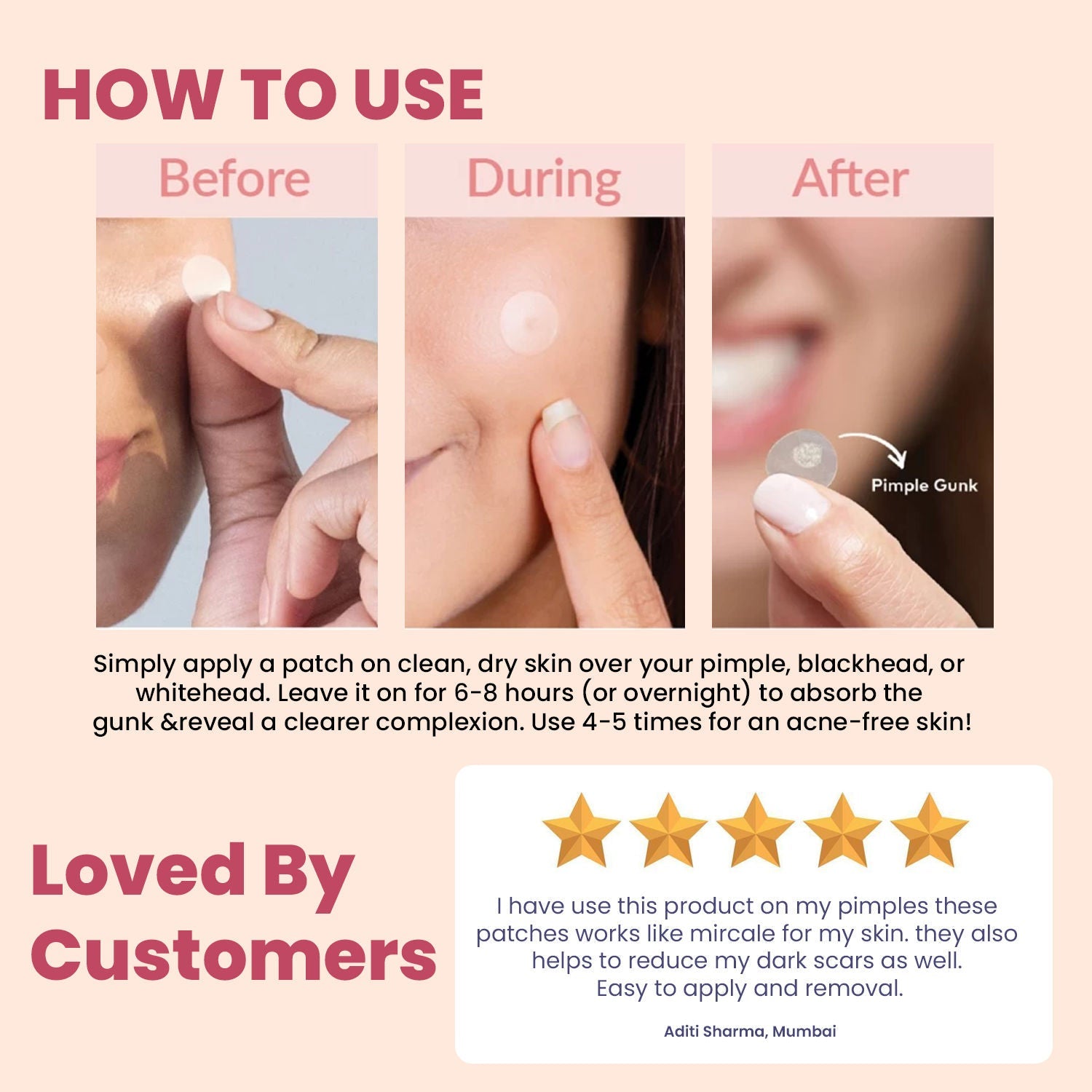 WILDGLOW Acne Pimple Patches