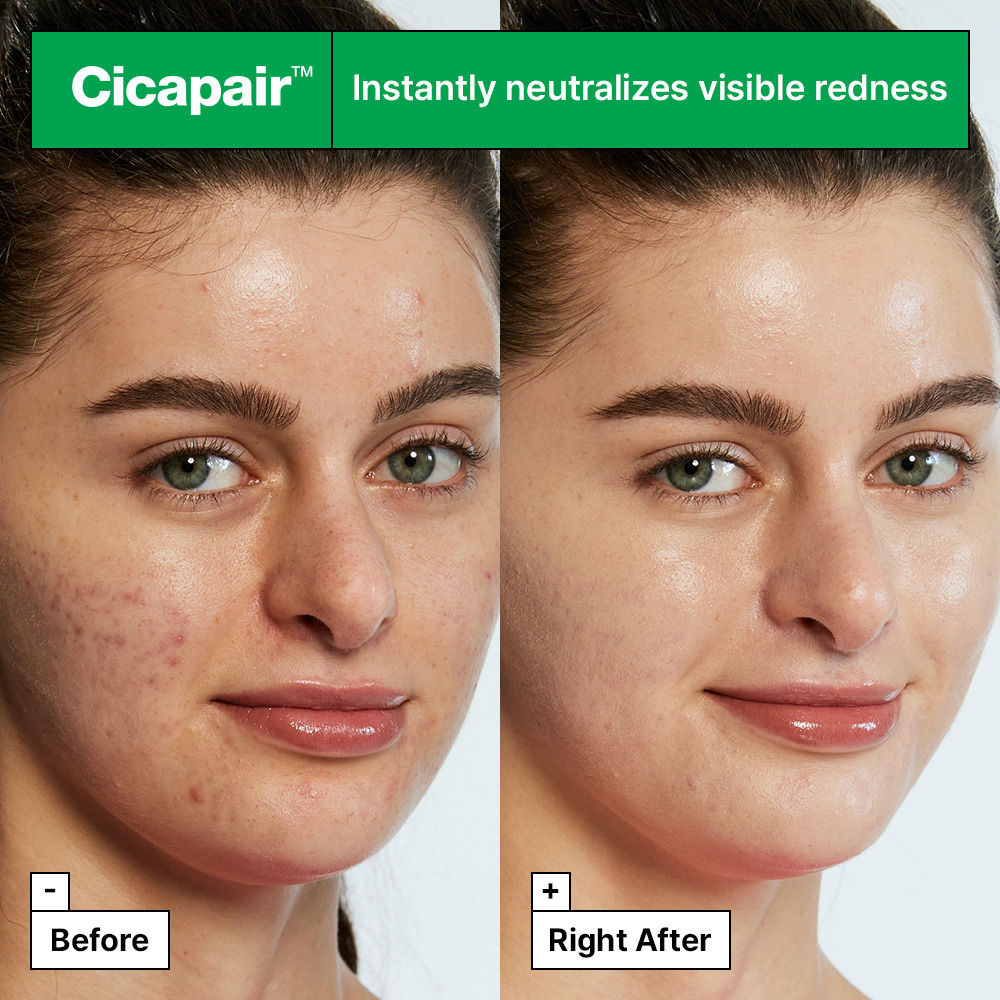 Dr.Jart+ Cicapair Tiger Grass Color Correcting Treatment With Cica Extracts & Niacinamide (Dermatologist Tested)