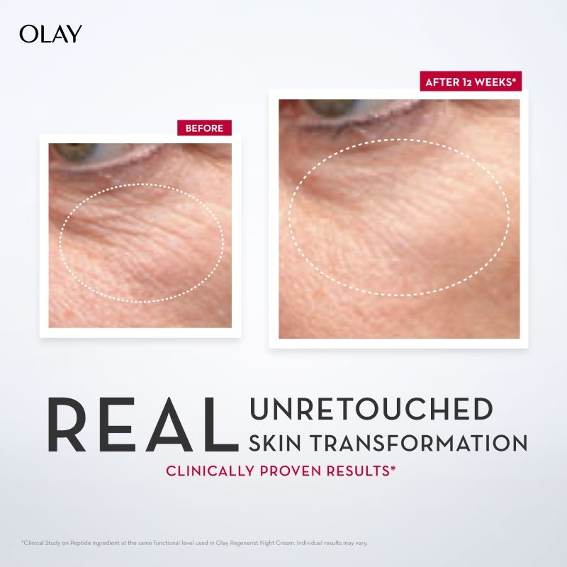 Olay Regenerist Micro Sculpting Serum, Plump & Bouncy Skin, With Hyaluronic Acid & Niacinamide