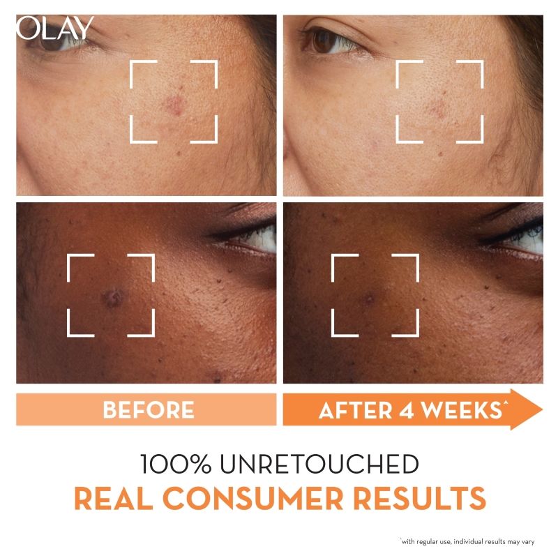 Olay Luminous Niacinamide Vitamin C Moisturiser