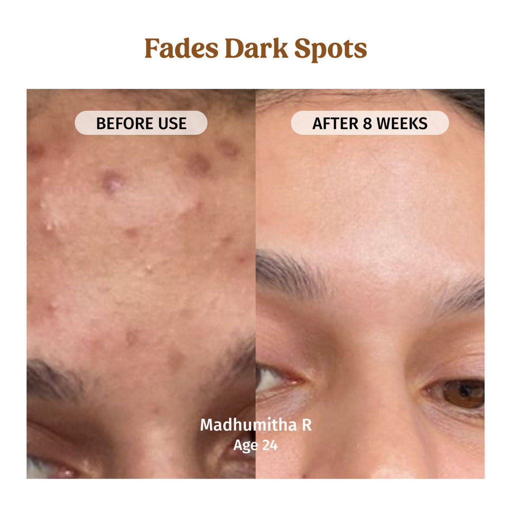 VILVAH Milk Drops Skin Brightening Serum With Rice Milk, Marine Algae Extract & Alpha-Arbutin