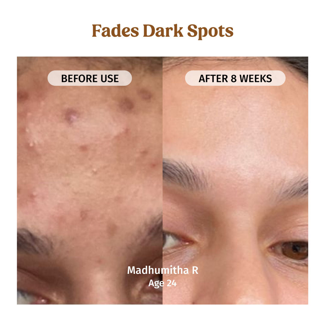 VILVAH Milk Drops Skin Brightening Serum With Rice Milk, Marine Algae Extract & Alpha-Arbutin