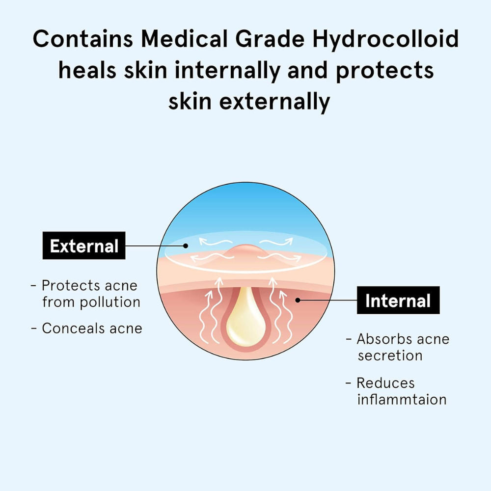 Be Bodywise Hydrocolloid Acne Pimple Patch Absorbs & Flattens Acne Overnight