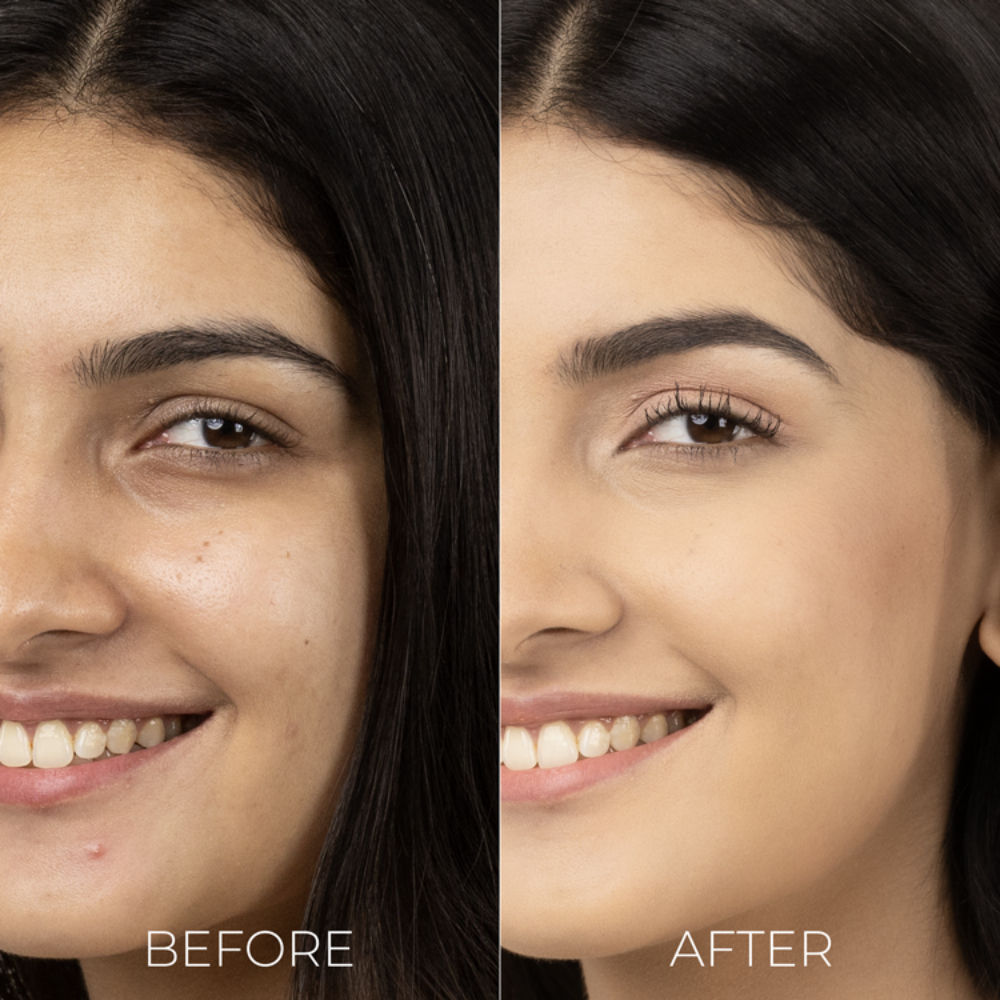 Brillare Skin Brightening Moisturizers For Reducing Pigmentation
