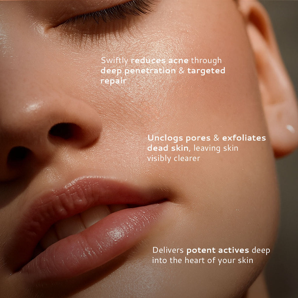 Lumineve 2% Salicylic Acid Face Serum for Active Acne & Pores with Advanced NightRenew Complex