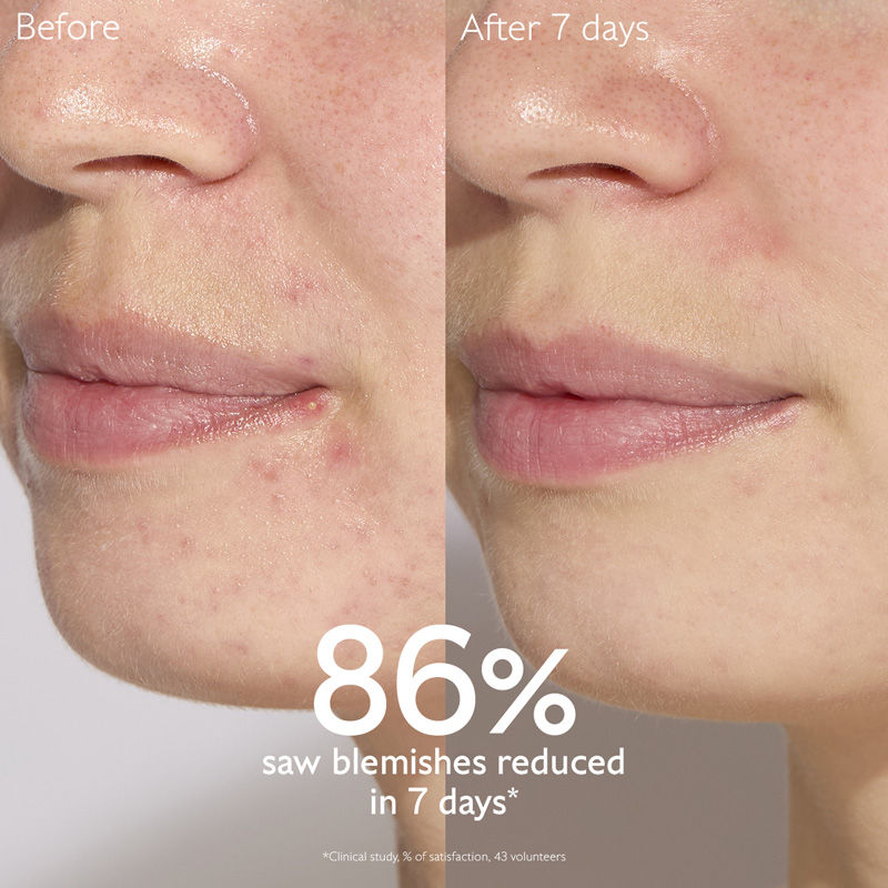 Caudalie Vinopure Blemish Control Salicylic Serum