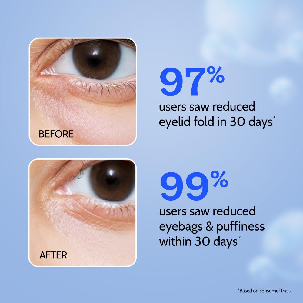 Chemist at Play Hydrating & Anti Aging Under Eye Cream for Dark Circles & Puffiness