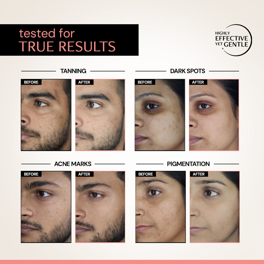 Deconstruct 5% Niacinamide Face Serum with Alpha Arbutin, For Acne Marks, Beginner Friendly
