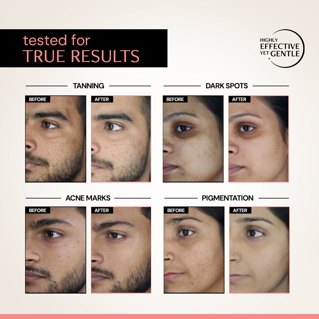Deconstruct 5% Niacinamide Face Serum with Alpha Arbutin, For Acne Marks, Beginner Friendly