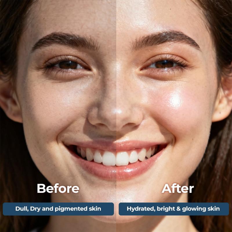 Neutriderm Moisturising Face & Body Lotion For Dry, Aging, Wrinkles, Acne, Red Skin With Vitamin E