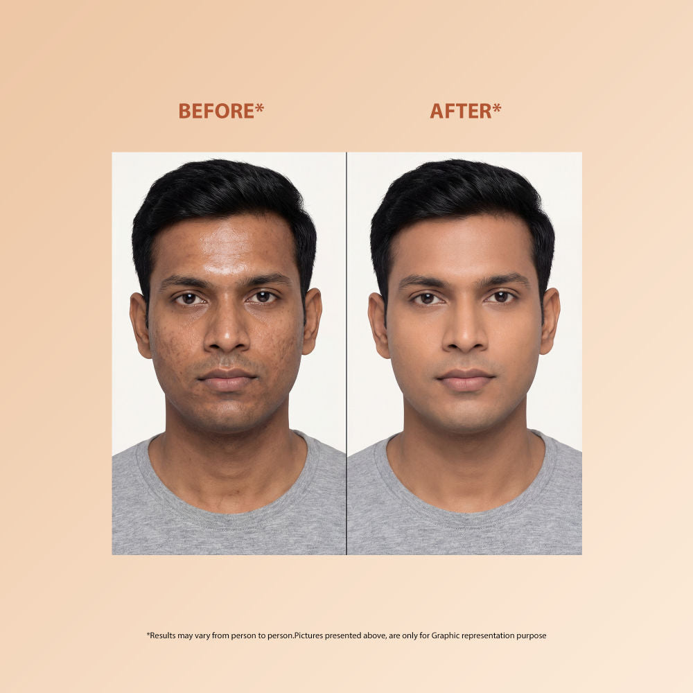 Proskire Skin Perfecting Niacinamide Serum