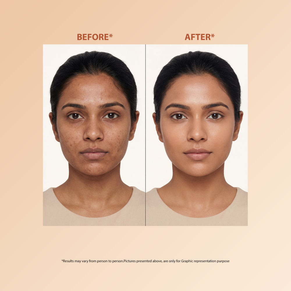 Proskire Skin Perfecting Niacinamide Serum