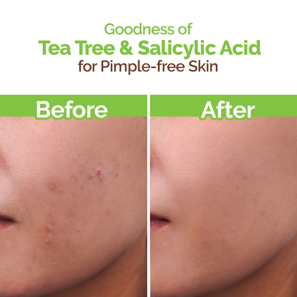 Mamaearth Face Wash With Tea Tree Oil And Neem Extract For Acne &pimples