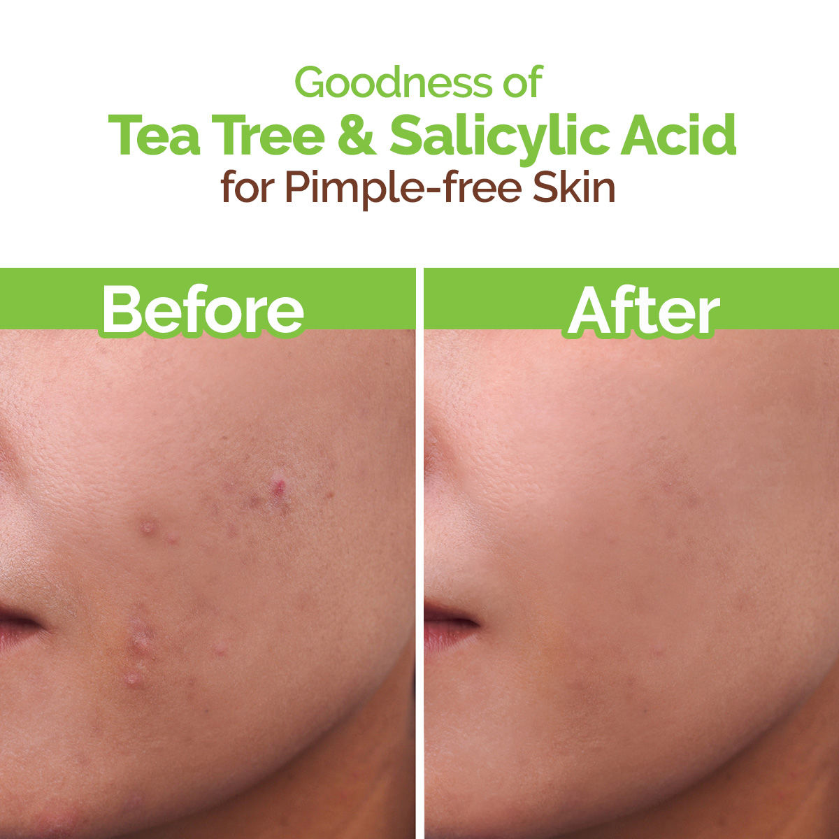 Mamaearth Face Wash With Tea Tree Oil And Neem Extract For Acne &pimples