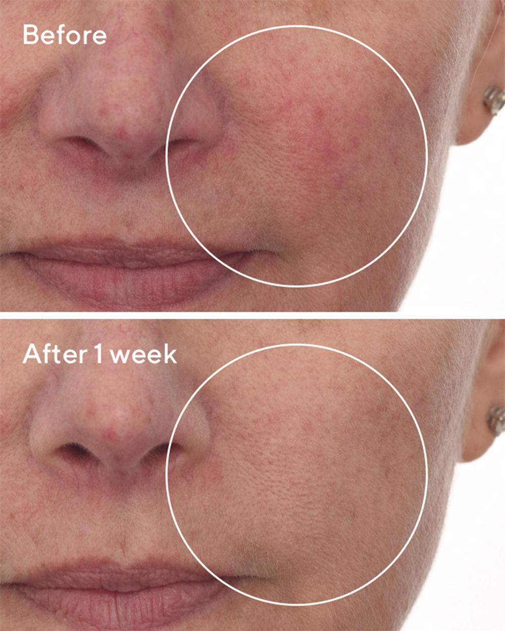 Murad Cellular Hydration Repair Serum