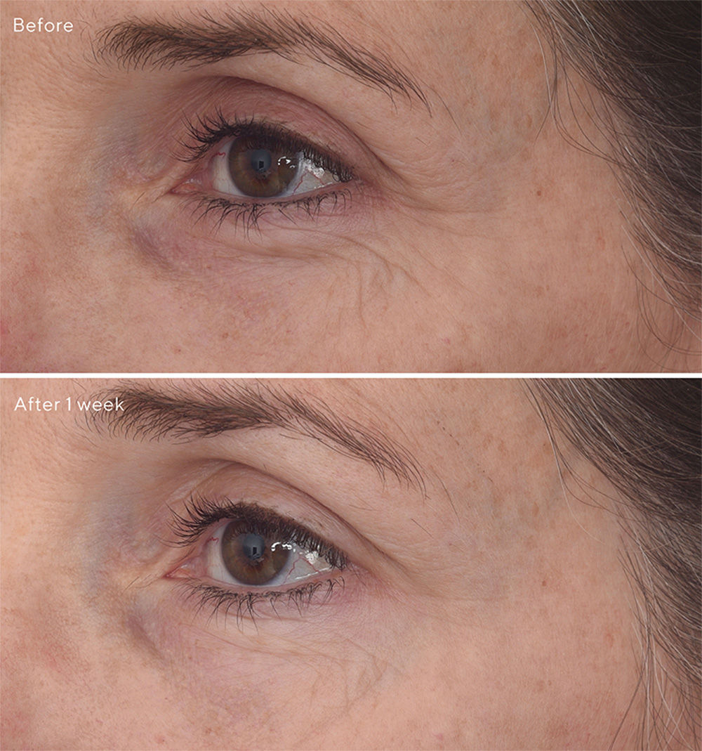Murad Retinal Resculpt Eye Treatment