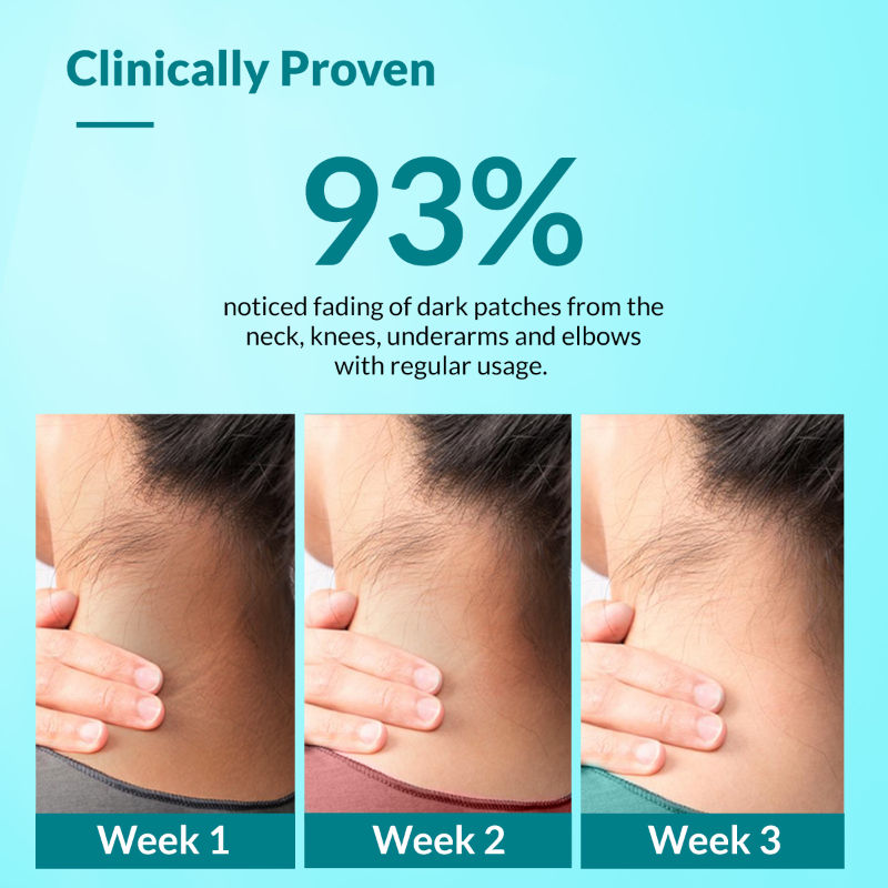 Fixderma Nigrifix Cream