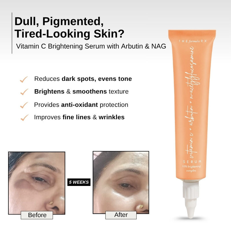 The Formularx Vitamin C Brightening Face Serum With Arbutin For Glow, & Dark Spots Removal