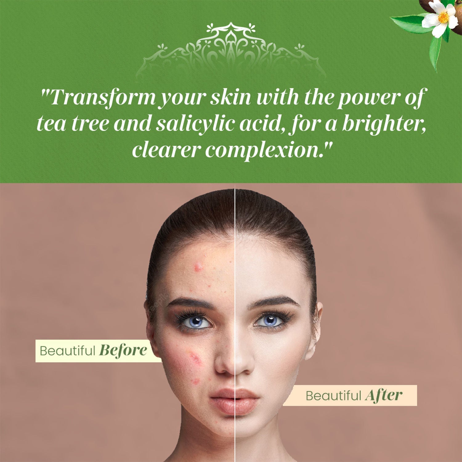 VITMINVEDA Tea Tree & Salicylic Acid Face Serum