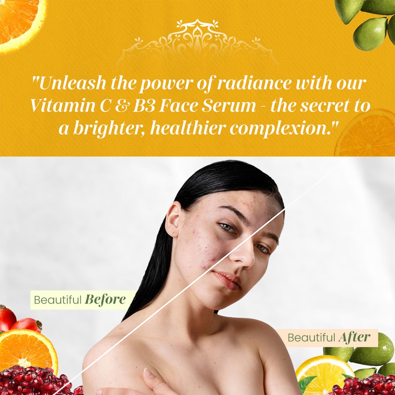 VITMINVEDA Vitamin C & B3 Face Serum For Natural Glow