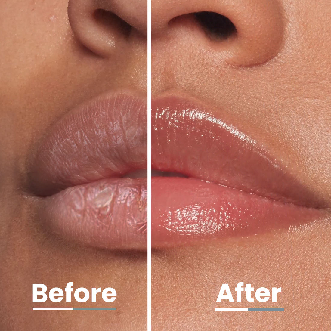 Hyphen Vitamin Infused Peptide Lip Balm - Peach For Dry & Chapped Lip, Hydrates & Moisturizes