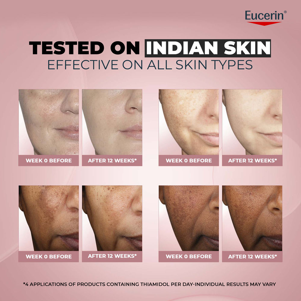 Eucerin Anti-Pigment Dark Circle Eye Corrector Serum With Thiamidol & Hyaluronic Acid For Bright Eye