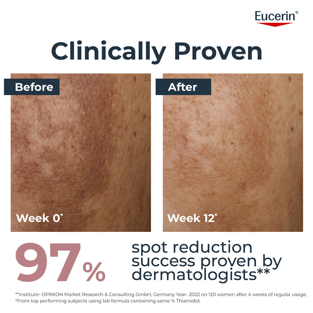 Eucerin Anti-Pigment Dark Circle Eye Corrector Serum With Thiamidol & Hyaluronic Acid For Bright Eye