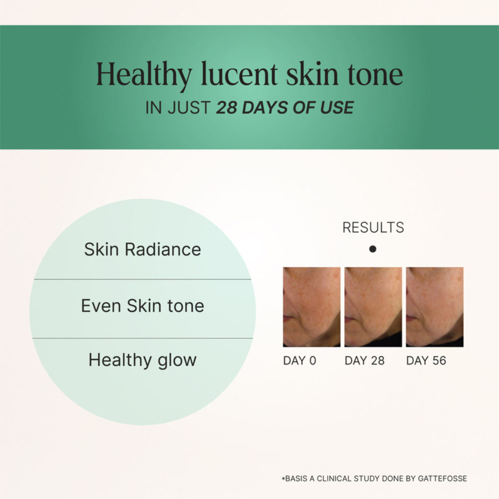 Oteria Sun Kissed Sun Care Gel With Aloe Vera Soothes Sun Damaged Skin, Suited For All Skin Types