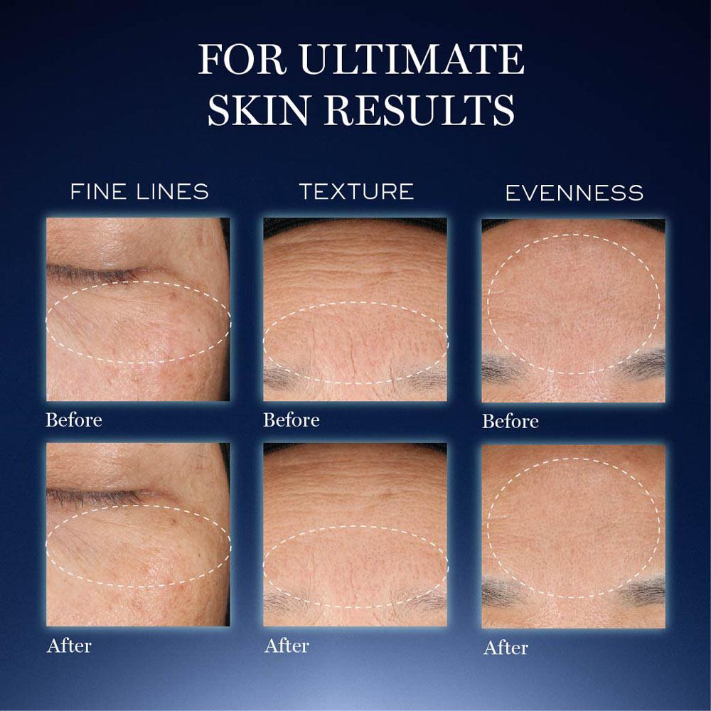 Lancome Genifique Ultimate Skin Repair Serum With Beta Glucan Suited for Indian Skin
