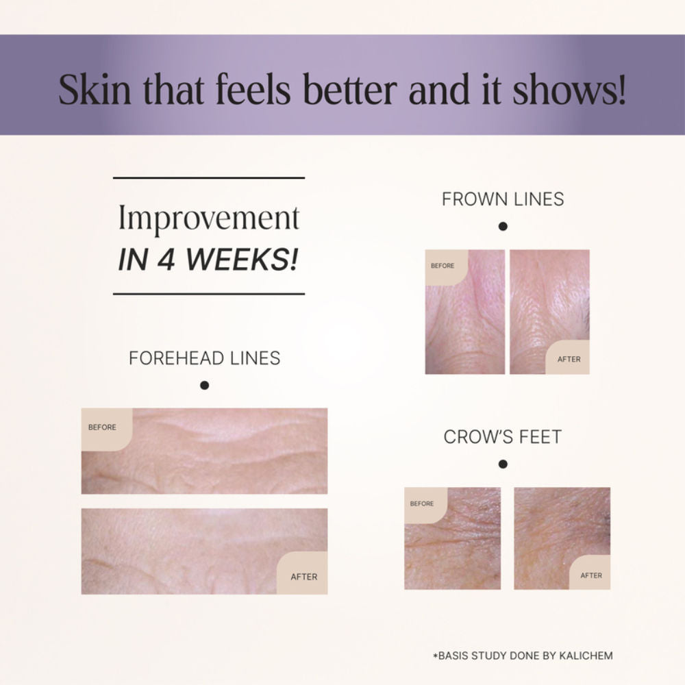 Oteria Lightweight Face Serum 1.5% Hyaluronic Acid Anti Aging Wrinkle Lift And Botox Like Effect