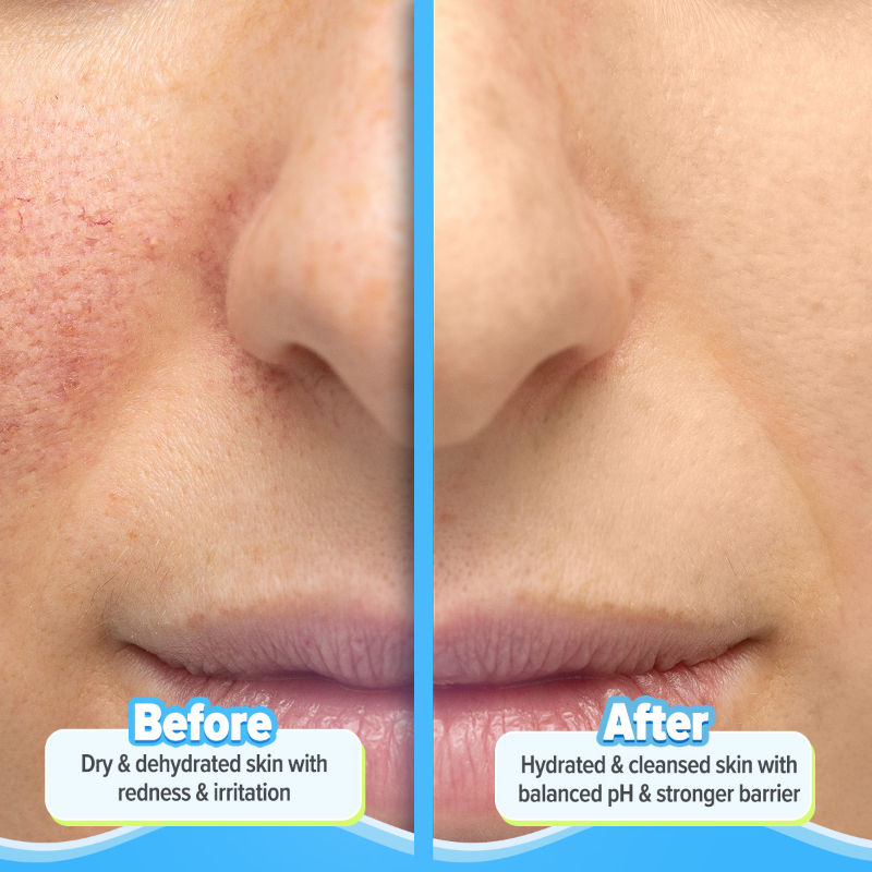 Aqualogica 5 Barrier + Repair Gentle Cleanser