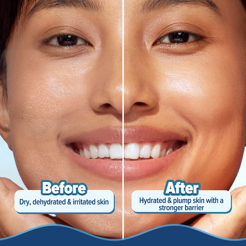 Aqualogica Barrier+ Hydra Gel Moisturizer With 5 Ceramides & Avocado For 24 Hour Intense Hydration