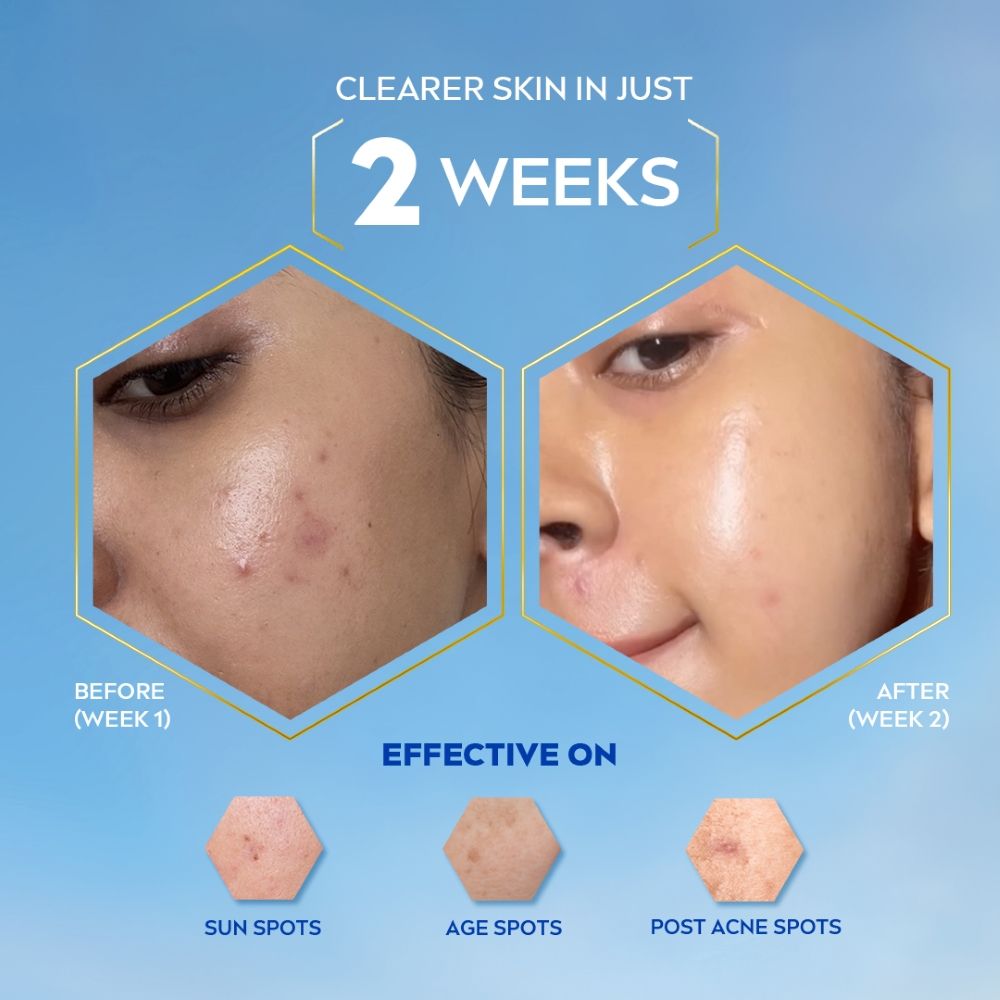 Nivea Luminous Even Glow Oil Control Serum Thiamidol, Salicylic, Hyaluronic Acid Reduces Dark Spot