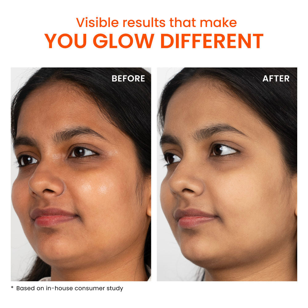Foxtale SPF 50 Aqua-Gel Lightweight Sunscreen for Oily Skin, In-Vivo Tested PA++++, Matte Finish.